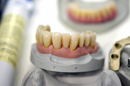人类的牙齿的模型