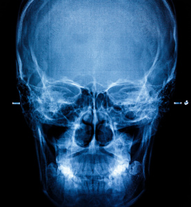 Foto rntgen scan mnskliga