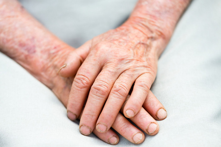 老人手照片