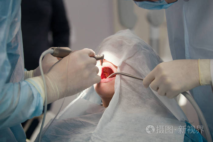 牙科外科医生在手术室做口腔手术病人照片-正版商用图片07dovs-摄图新