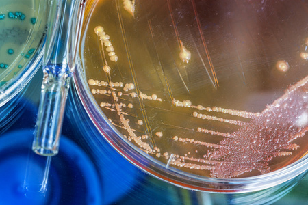 霍乱弧菌试管和培养皿照片