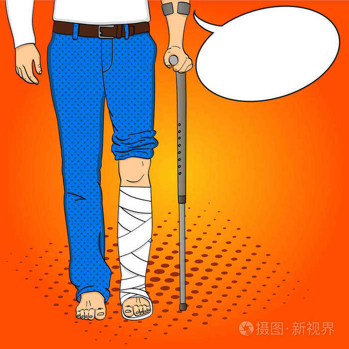 流行艺术男子腿石膏, 拐杖和支持.康复手段.矢量仿漫画风格.文本气泡
