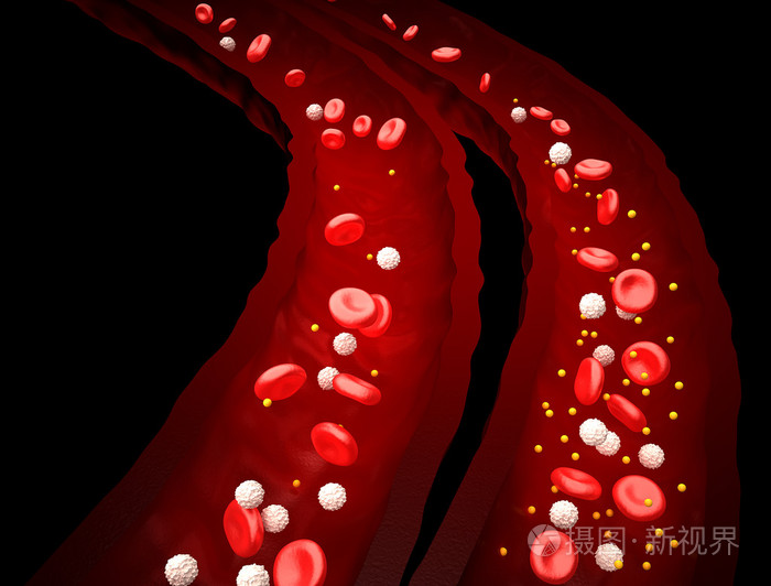 血液流正常与糖尿病