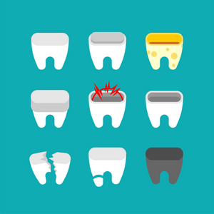 生病的牙齿设置。龋齿和断牙。牙医向量例证