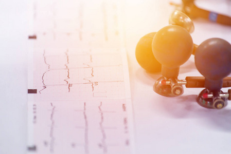 住院患者心电图记录电极心电图或心电图腿的研究