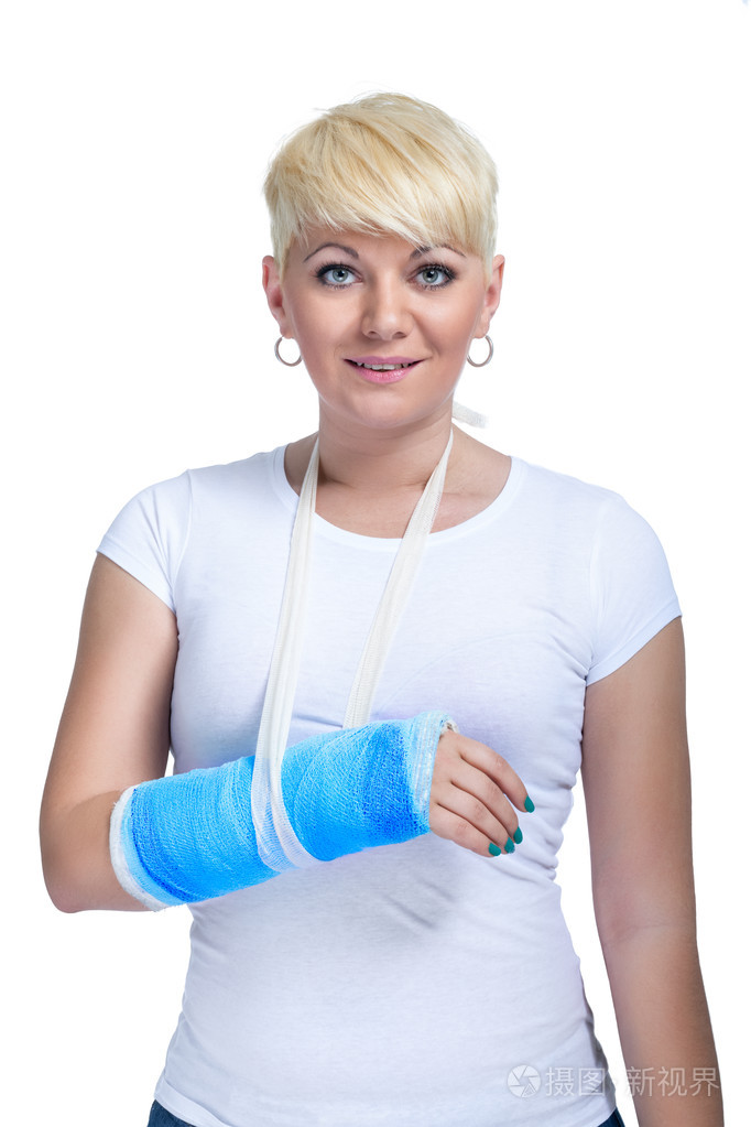 用断胳膊的女病人