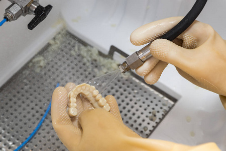 牙科技师清洁3d 打印牙种植桥