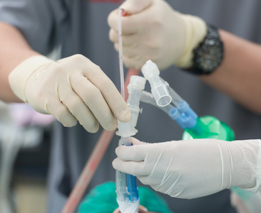 麻醉护士使用吸吸痰液中双腔 endotrachal插入气管内