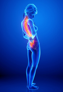 用蓝色突出显示脊髓损伤人体脊柱疼痛的插图