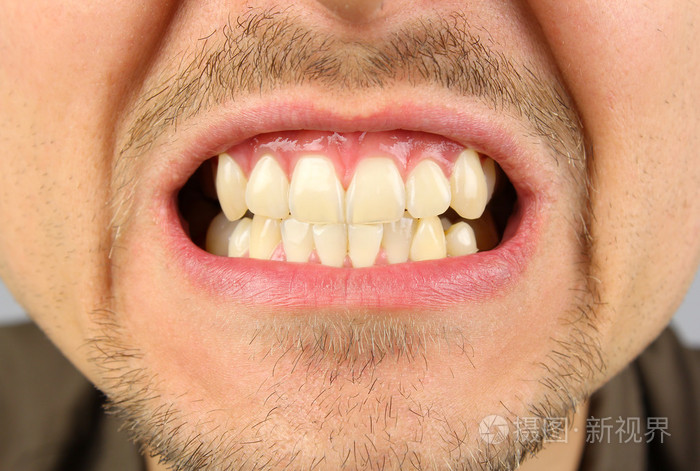男性的嘴，牙咧嘴