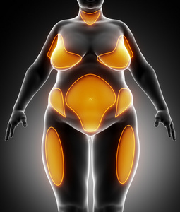 概念肥胖超重肥胖女性 vs 后减肥苗条身材健康的身体,或肌肉瘦的年轻