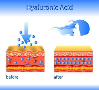 与化妆品填料或透明质酸在光背景的向量例证