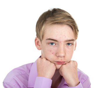 他脸上的痤疮的少年照片