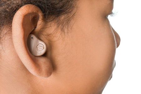 失聪的孩子助听器小女孩特写照片