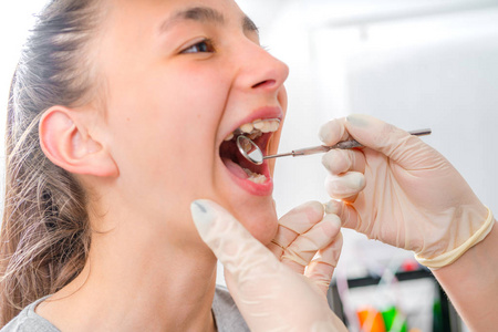 牙医检查牙套对患者
