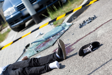 出血在车祸中受伤断指出血出血性伤口受伤的腿受伤流血的男孩受伤的脚