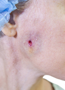 照片系列: 美容.并发症.