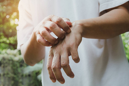 人用手抓痒.男人抓他的手医疗保健概念照片