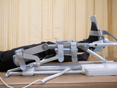 膝关节手术膝关节手术后的膝部 cpm 装置康复治疗照片