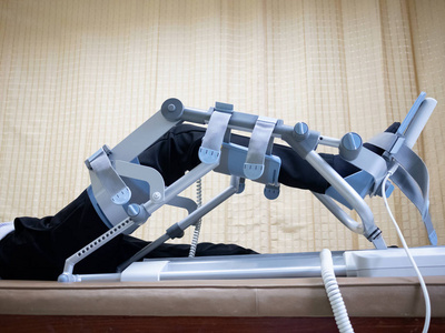 膝关节手术后的膝部 cpm 装置康复治疗照片