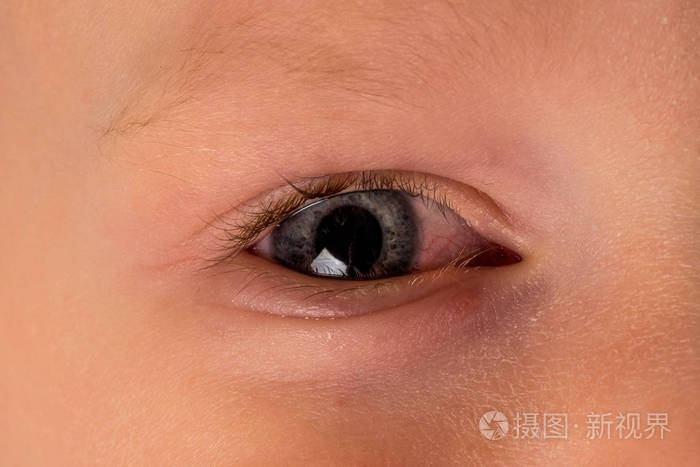 小孩怎样让鼻子通气_怎样让鼻子快速通气_鼻子堵了怎么办快速通气小孩吃什么