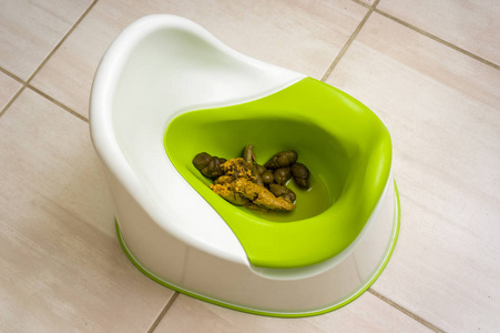 宝宝大便婴儿便盆内不愉快的儿童排泄物照片