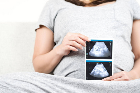 坐在沙发上的快乐孕妇的软焦点和模糊在她的腹部上拿着超声波扫描照片
