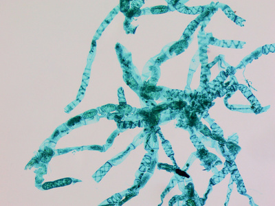 水绵水绵显微图像照片