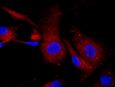 荧光分子标记的间充质干细胞