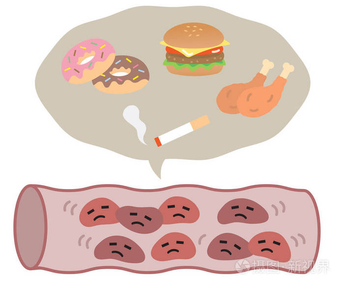 吃垃圾食品和吸烟增加血液胆固醇和导致不健康的血管插画-正版商用