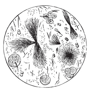 亮氨酸球, Tyrosin 滑轮, 老式雕刻插图