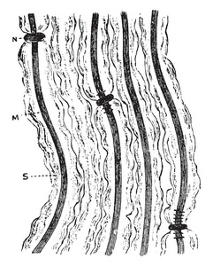 硝酸银有髓神经纤维束的几种纤维表现出 Ranvier复古线图或雕刻插图中节点的特殊行为