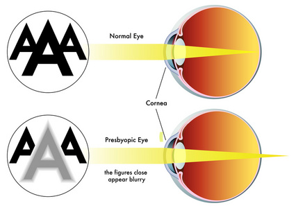 老花眼图片