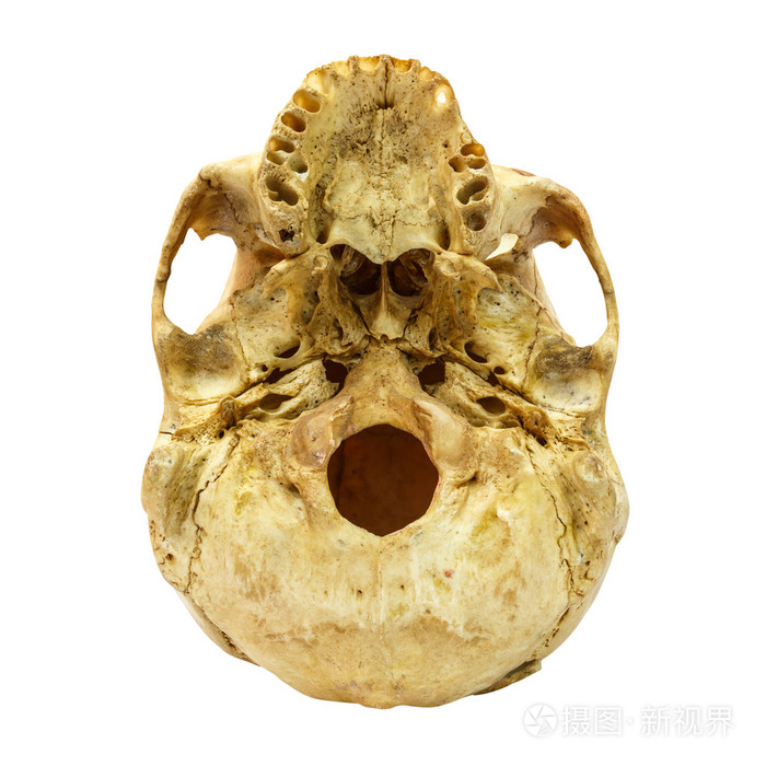 人类头骨 fracture(beneath) (蒙古人种,亚洲) 孤立的背上