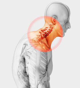 3d 图，脖子痛颈椎骨骼 x 射线 医疗概念