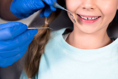 裁剪的牙医的镜头与工具检查牙齿的微笑的小孩
