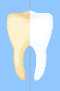 牙齿美白概念