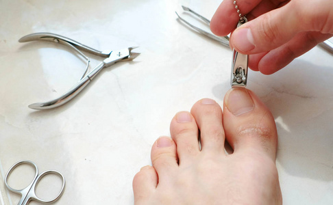 脚上肉刺用剪刀剪脚趾甲的人.男士脚上切脚趾甲.脚和脚趾特写.