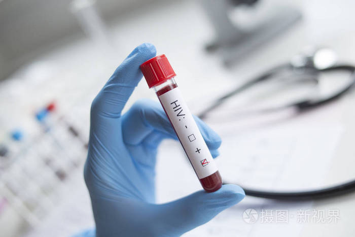 诊断人员手部进行了hiv阳性试验