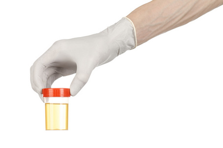 医疗主题 医生的手中抱着一个透明的容器与尿液分析的白色背景上的白手套