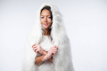 一个美丽的非洲女孩的皮肤问题是穿着温暖的白色人造毛皮.