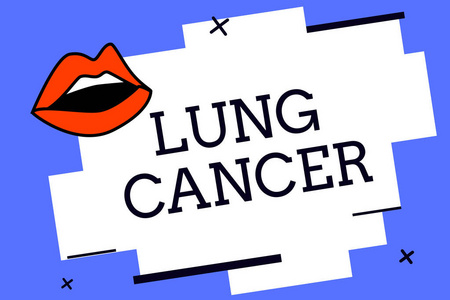 写说明肺癌的笔记。商业照片展示在肺部开始的异常细胞的失控增长