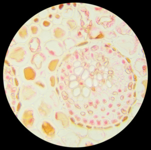 显微镜下切片蕨叶(蕨叶sec)照片