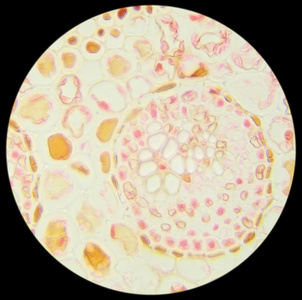 显微镜下切片蕨叶(蕨叶sec)照片