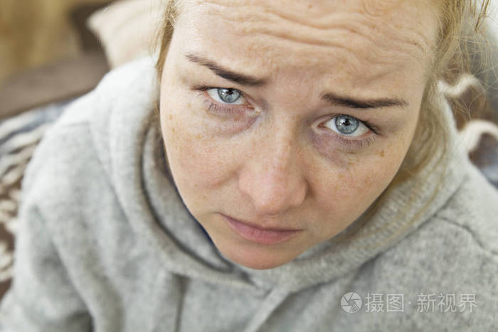 蓝眼睛的年轻女人头疼。健康与痛苦