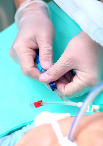 医生给病人的导管照片