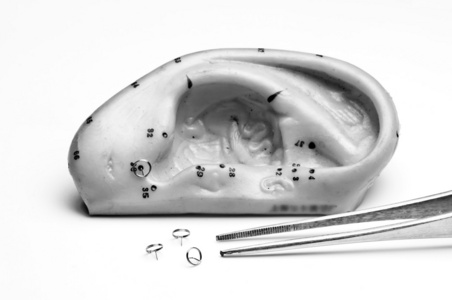 针灸针和耳模型