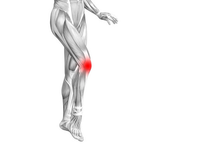 概念性膝关节人体解剖学与红色热点炎症或关节关节疼痛的腿保健治疗或运动肌肉的概念。3d. 图示人关节炎或骨质疏松症