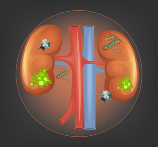 肾脏有各种细菌和细菌。矢量图