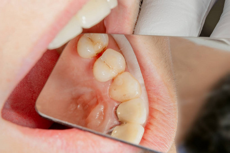 牙科诊所的牙科治疗理念照片